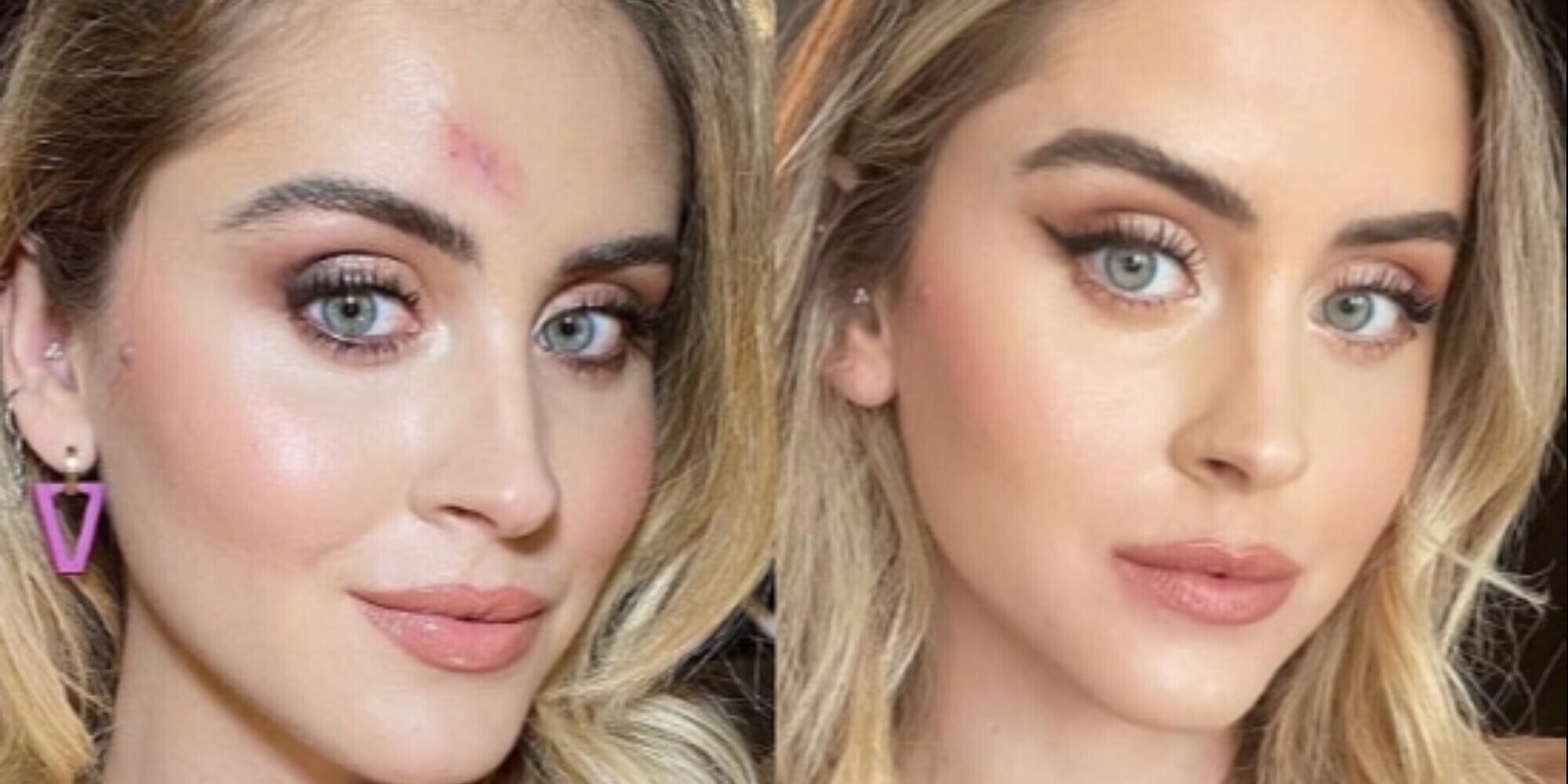 Valentina Ferragni ricorda il tumore: "Tutto quello che è successo dopo..."