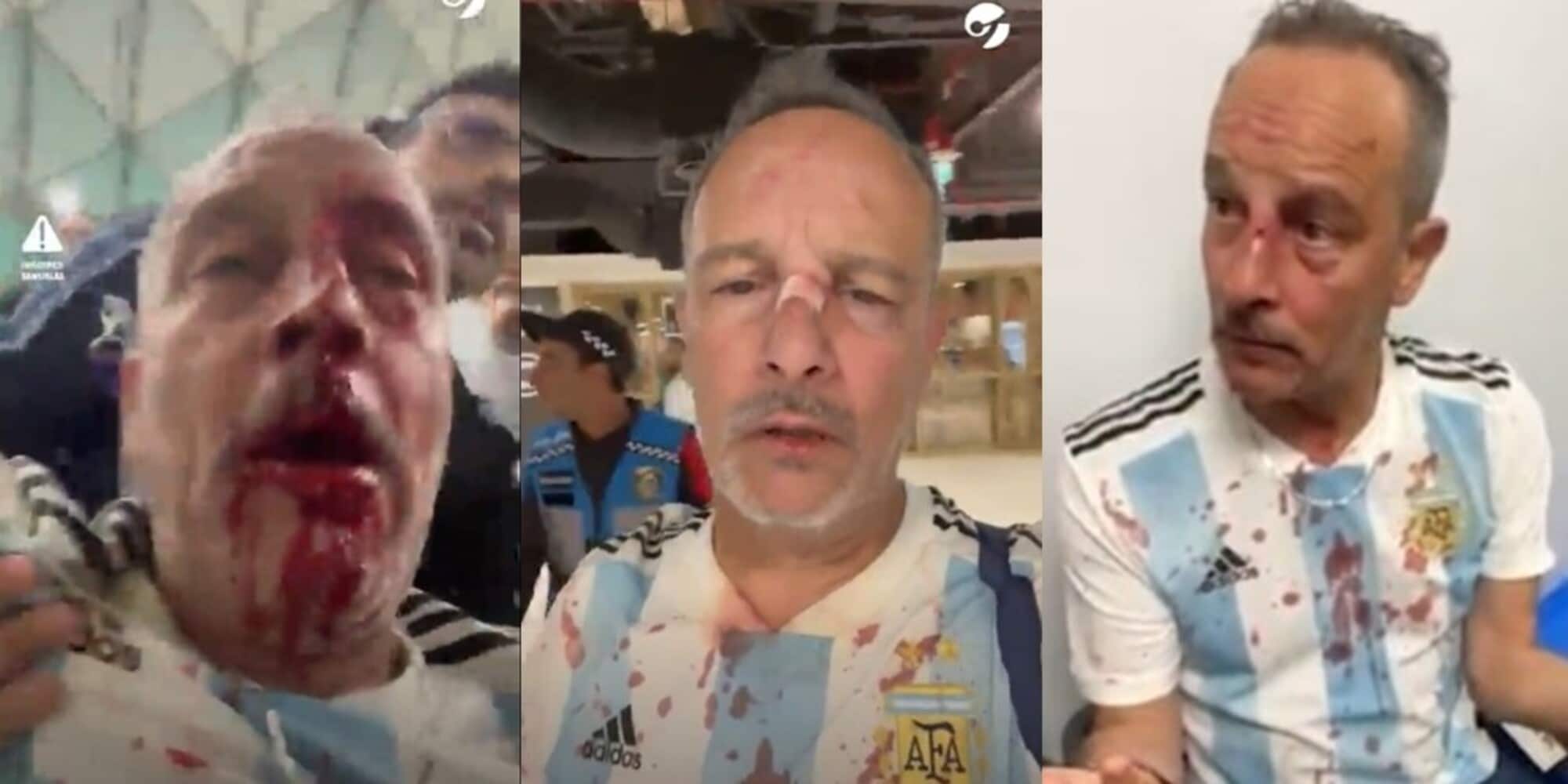 Tifosi argentini pestati a sangue: “I messicani ci sono venuti a cercare”
