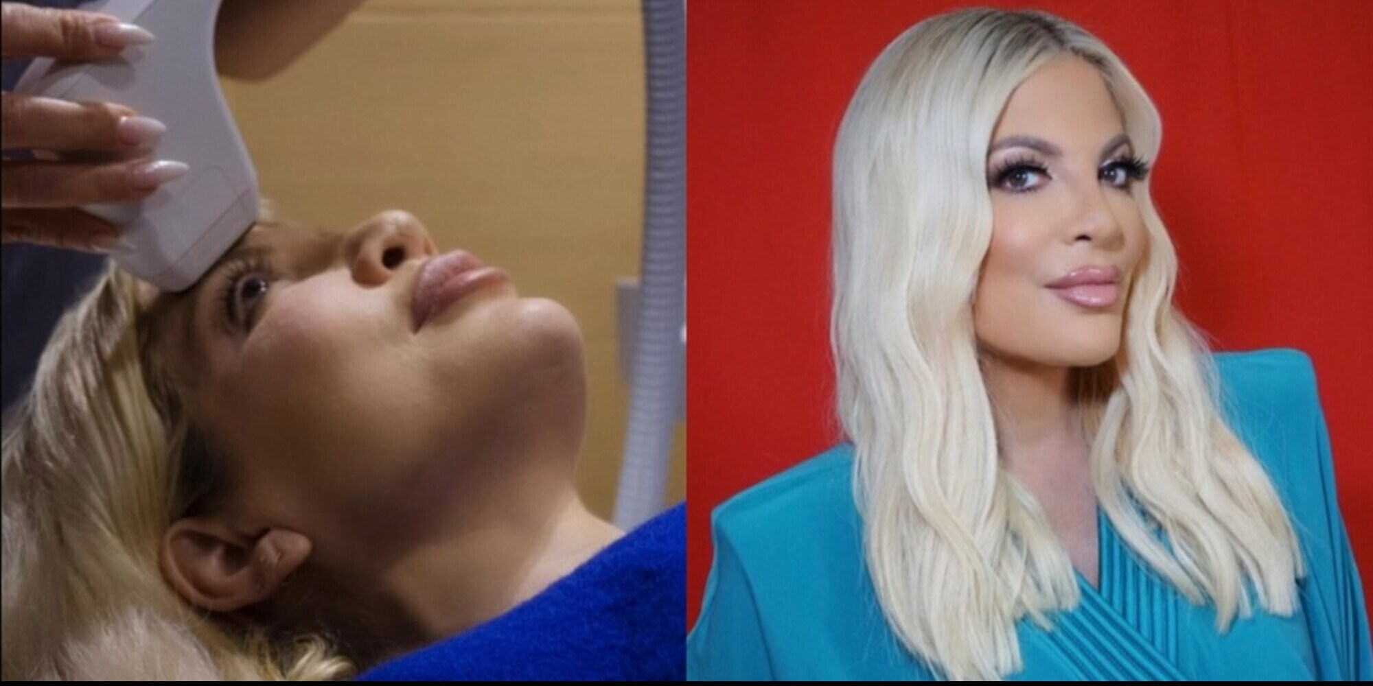 Tori Spelling ricoverata: c'è un motivo, ecco la spiegazione