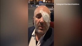 Ternana, Bandecchi e lo scherzo shock: "Mi hanno spappolato un occhio"