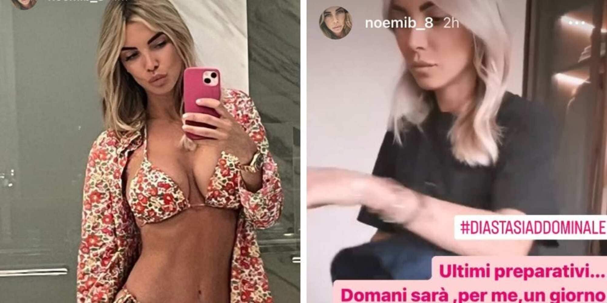 Noemi Bocchi e la diastasi: quando e dove si opera e le sue parole