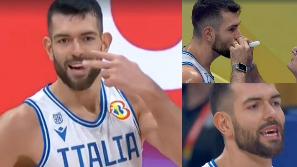 Ricci, duro contrasto durante Italia-Usa: gomitata e sangue