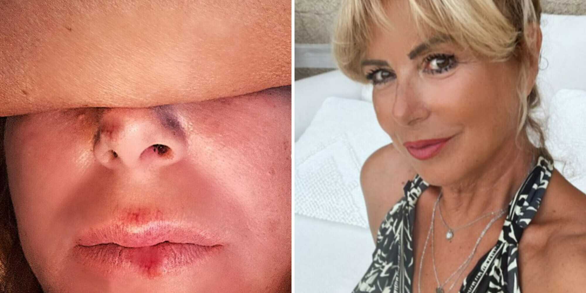 Monica Leoffredi shock sui social: "Investita e insultata a Roma"