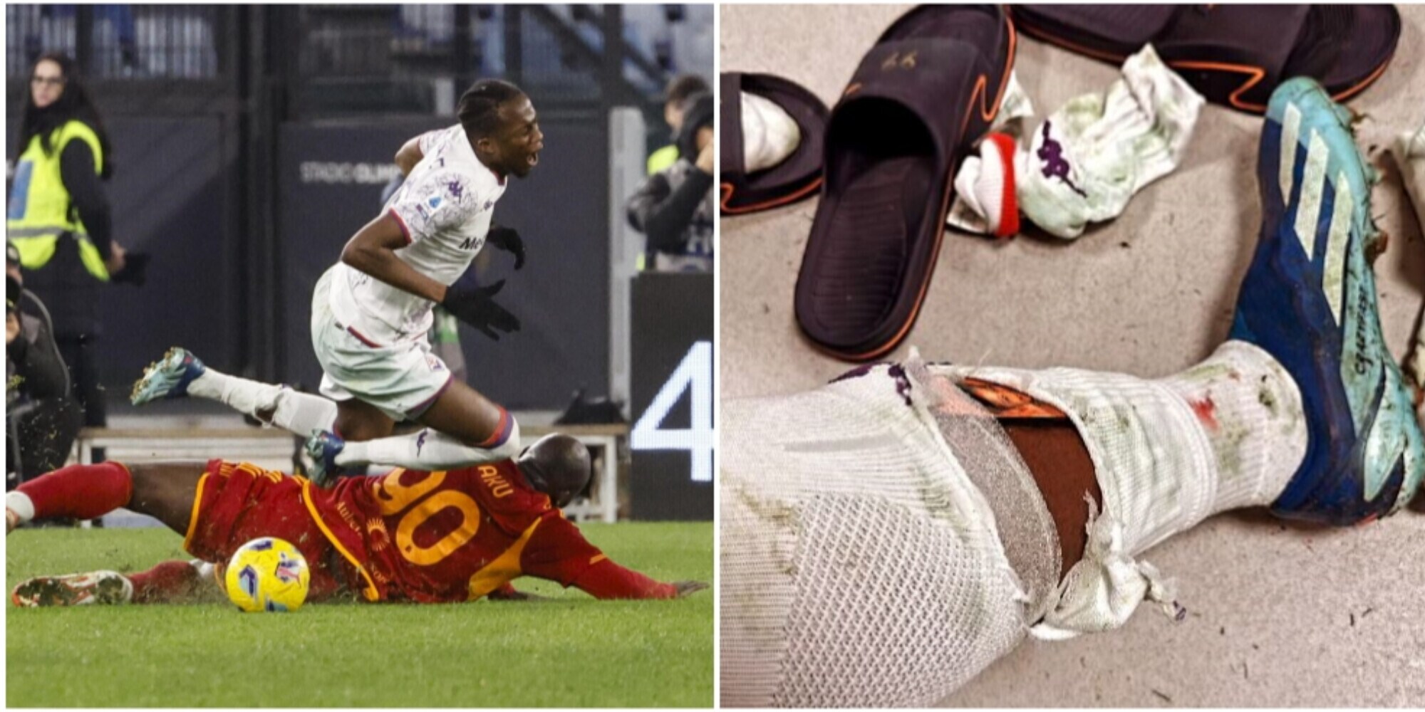 Kouame dopo il fallo di Lukaku: foto della gamba ferita e messaggio social