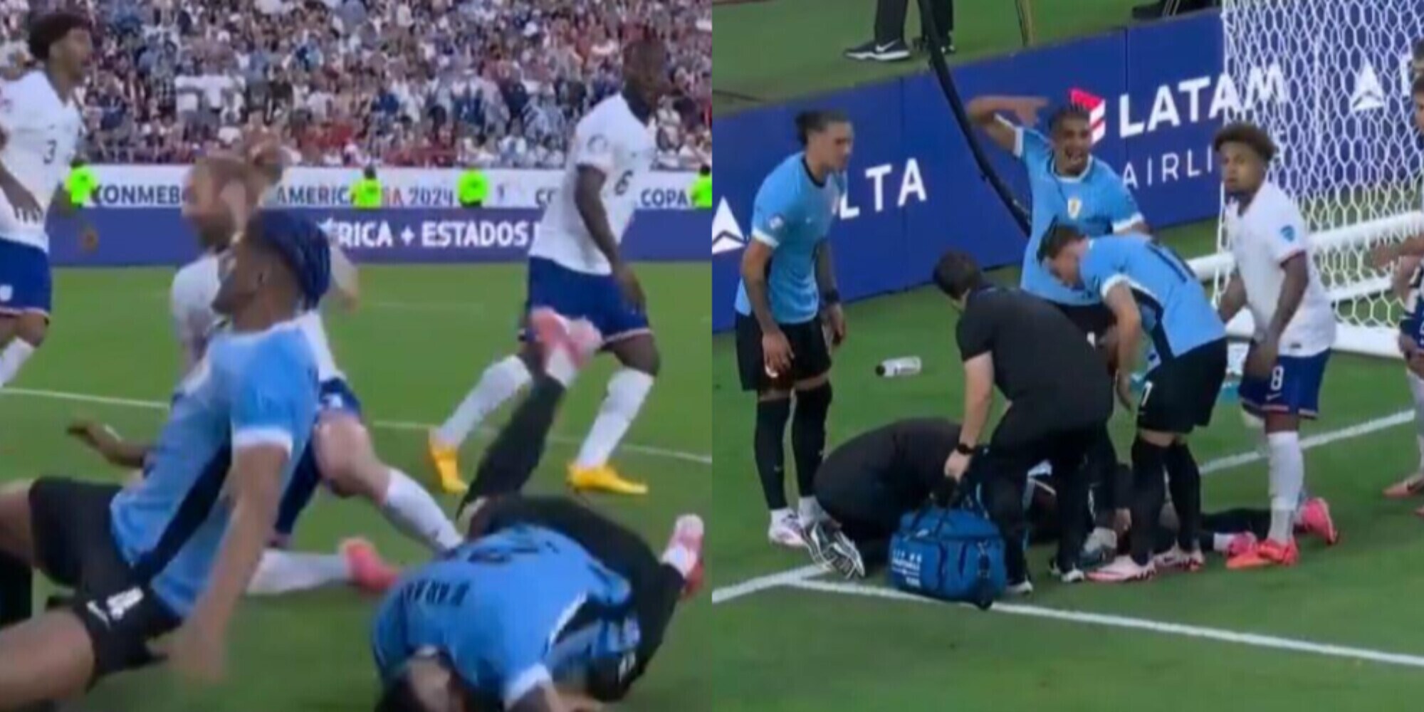 Infortunio al collo per Araujo, esce in barella: le immagini shock in Coppa America