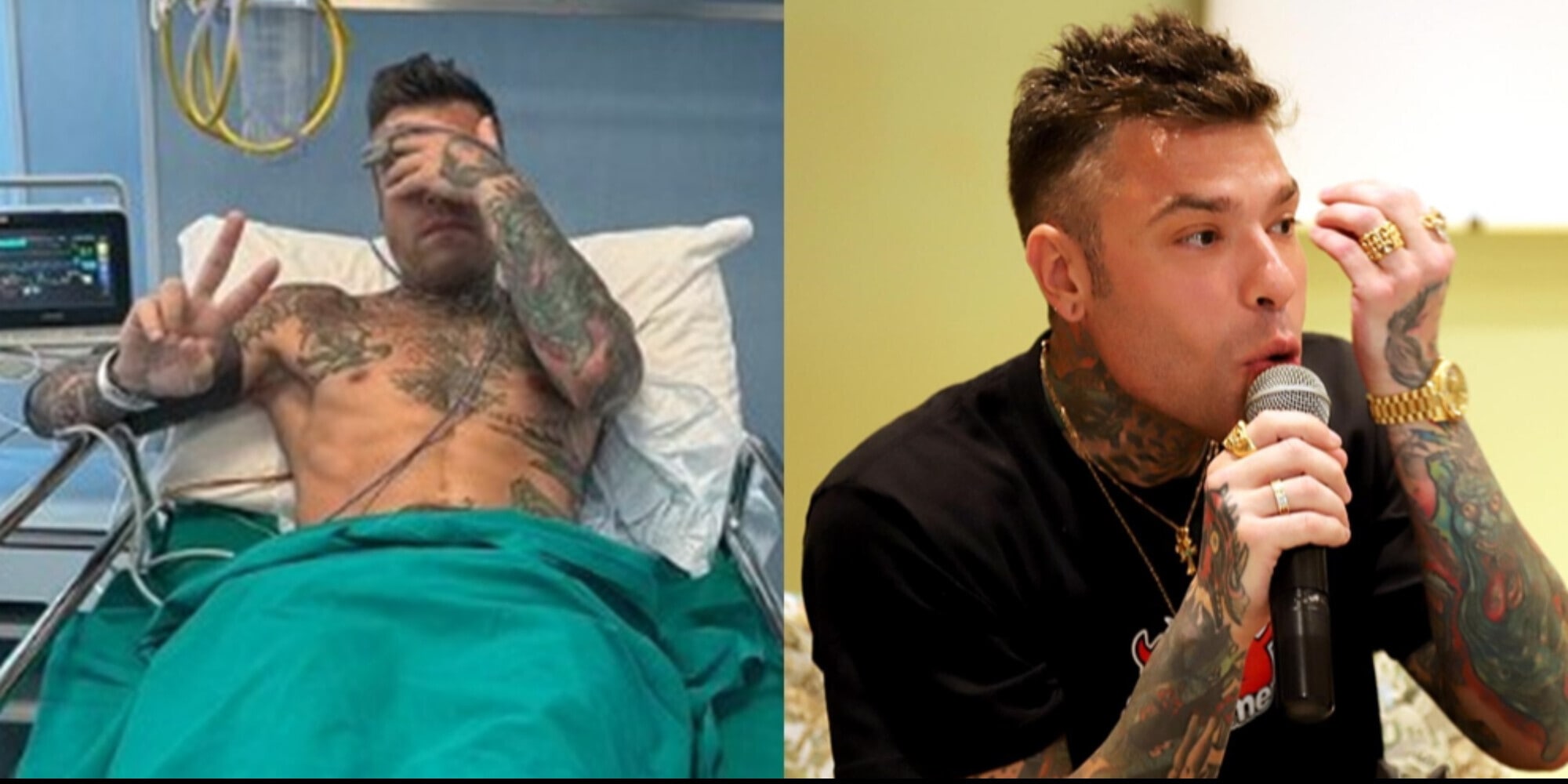 Paura per Fedez in ospedale per un'emorragia: come sta ora