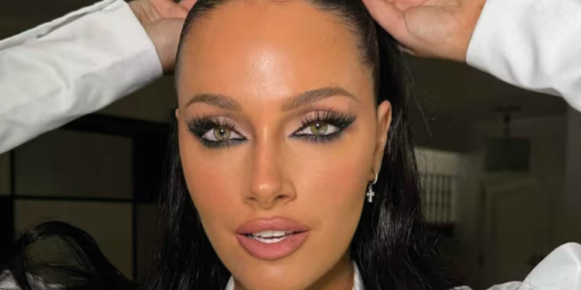 Oriana Sabatini e il trattamento al plasma per avere il viso perfetto