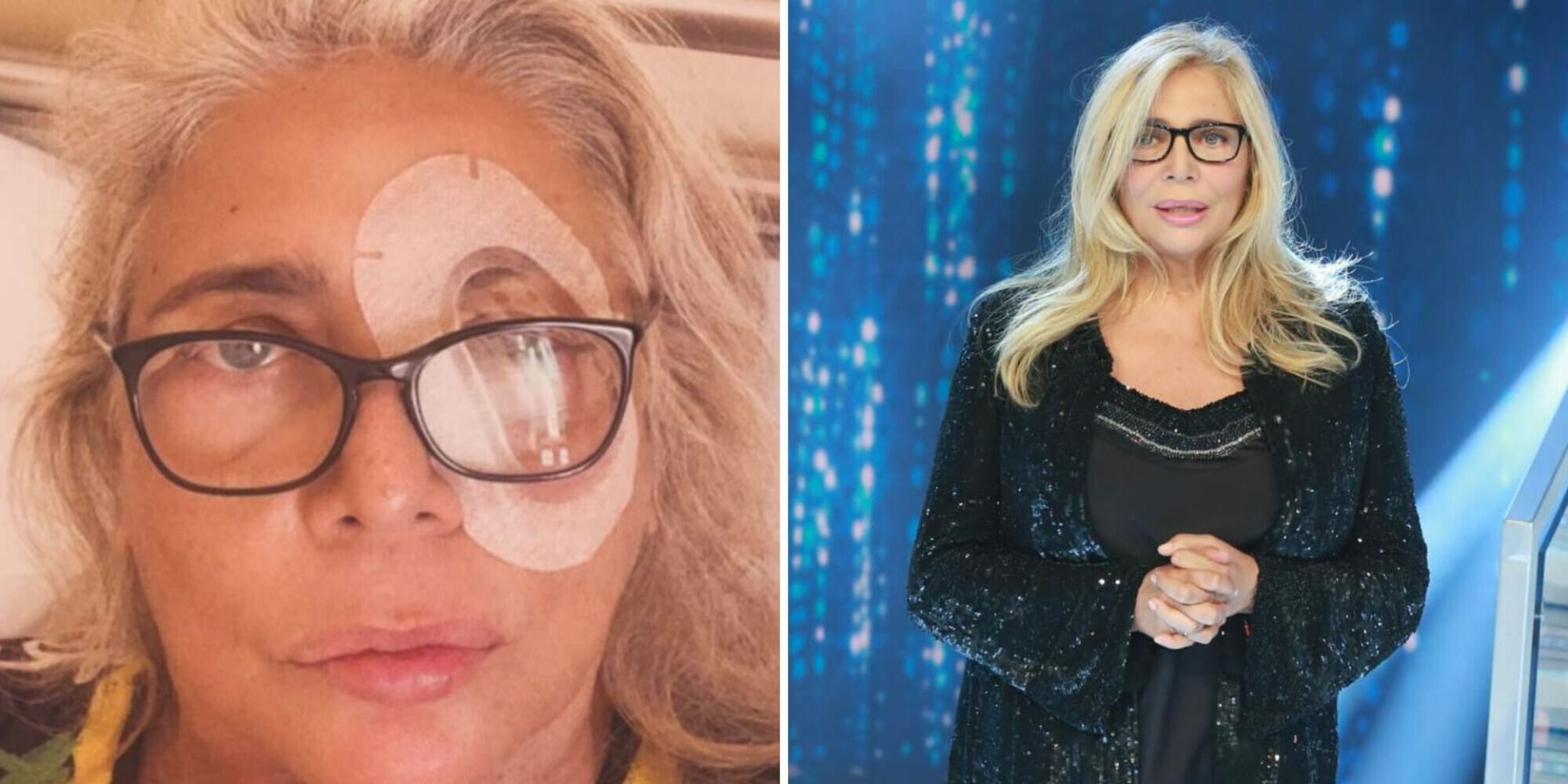 Mara Venier operata tre volte all’occhio: "Ora spero di recuperare la vista"