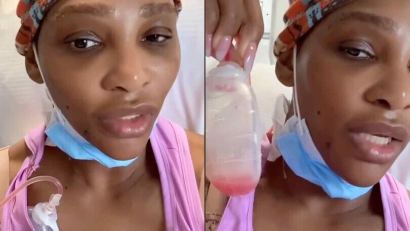 Serena Williams operata al collo: "Era grosso come un pompelmo"