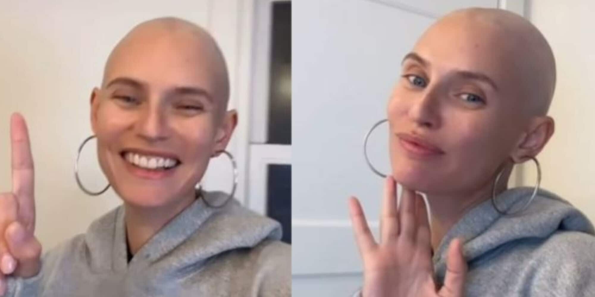 Bianca Balti si mostra senza capelli per la chemioterapia