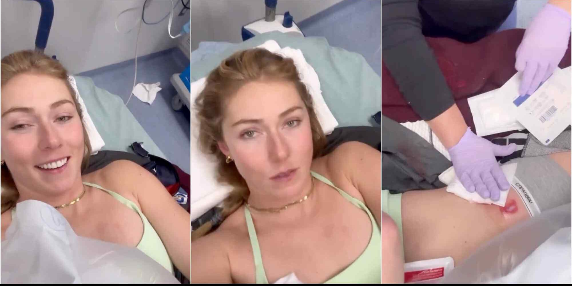 Shiffrin mostra le ferite: "Non riesco a muovermi, ma tutto bene..."