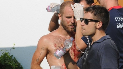 Bologna-Spezia, scontri e feriti prima dell'amichevole