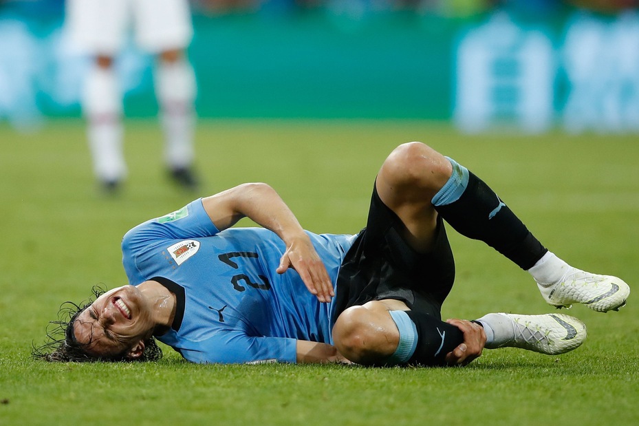 Cavani: «L'infortunio? Dio voglia che non sia nulla di serio»