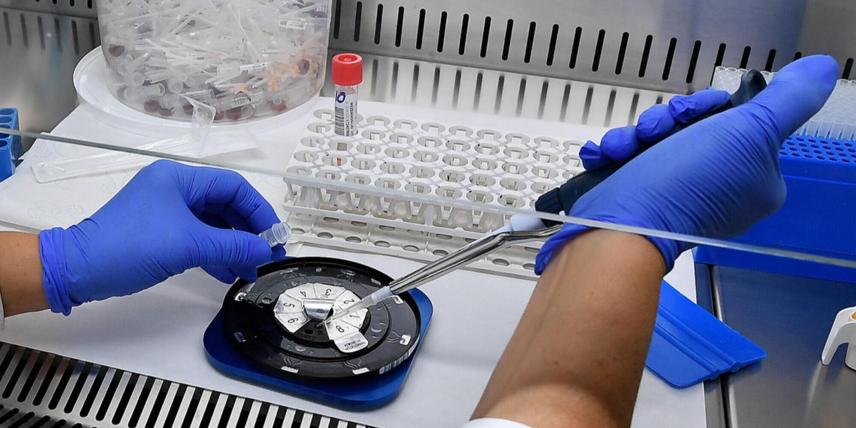 Vaiolo delle scimmie: cos'è, dov'è l'epidemia, perché fa paura