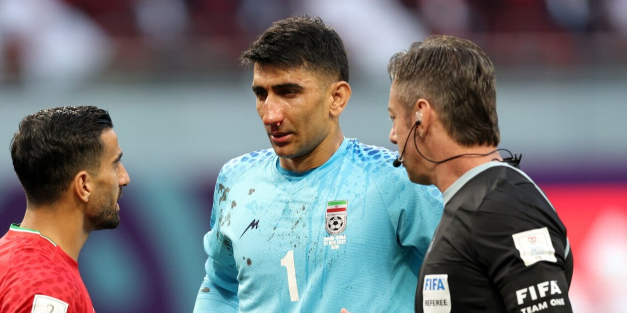 Beiranvand infortunato durante Inghilterra-Iran: chi è il portiere da record che fermò Ronaldo