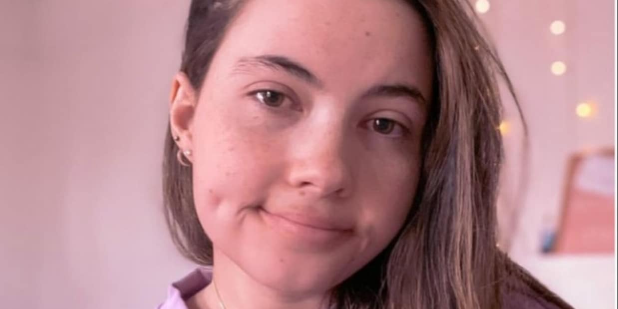 La ragazza allergica all'acqua: "La doccia ogni 2 mesi, ecco cosa bevo"