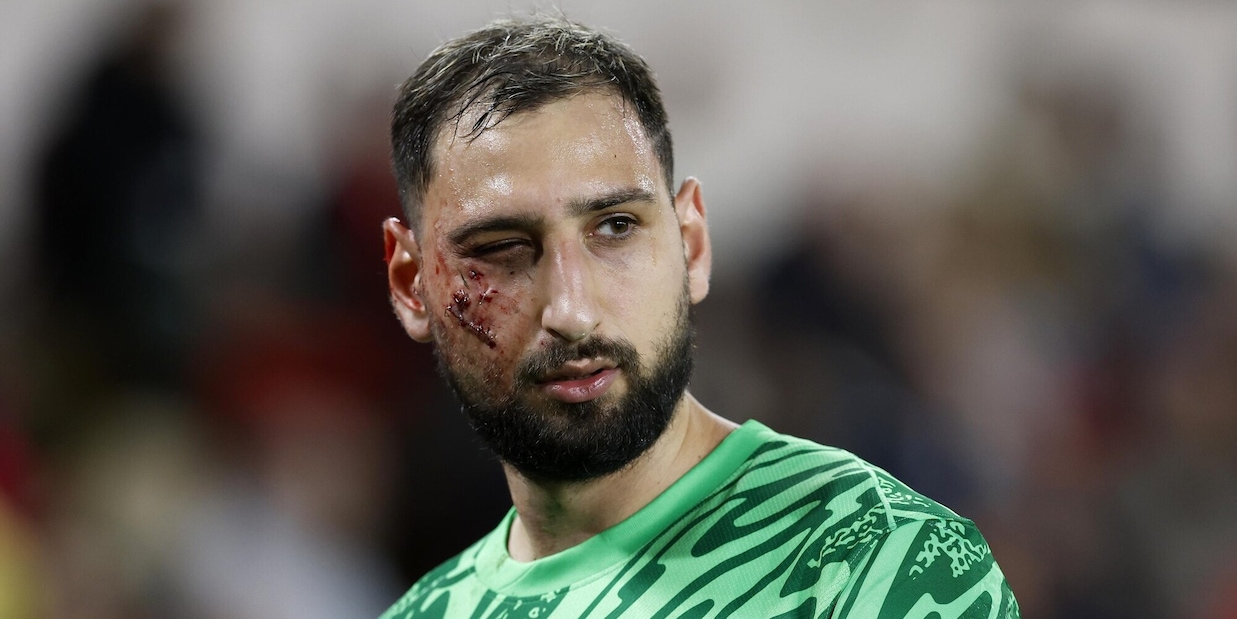 Insulti razzisti e minacce a Singo dopo il brutto fallo su Donnarumma: interviene il Monaco