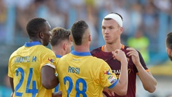 Dzeko, scontro aereo e fasciatura alla testa con il Frosinone