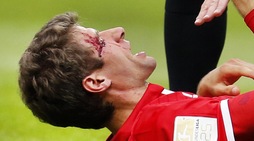 Bundesliga Bayern Monaco: Thomas Mueller, che taglio!