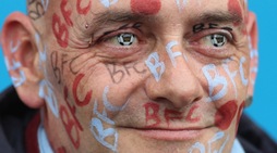 Il tifoso del Burnley con gli occhi nel pallone