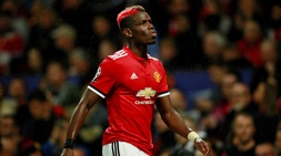 Pogba, nuovo look per festeggiare la fascia ma s'infortuna