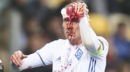 Domagoj Vida, scontro shock contro lo Young Boys