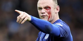 Rooney, infortunio choc al sopracciglio per una gomitata