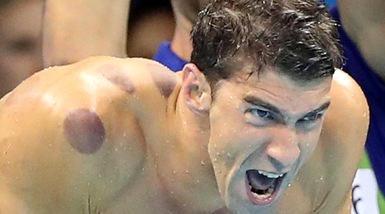 Olimpiadi, Phelps e quelle macchie da cupping