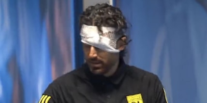 Ligue 1, solo pari per il Lione di Grosso. Zakaria trascina il Monaco, Farioli in vetta