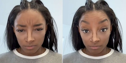 Simone Biles pentita del botox: "Non riuscivo più a..."