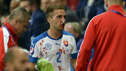 Slovacchia-Inghilterra, gomitata da Bertrand: paura per Pekarik