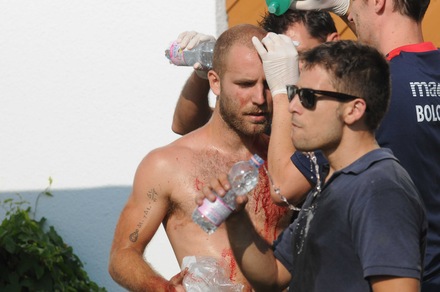 Bologna-Spezia, scontri e feriti prima dell'amichevole