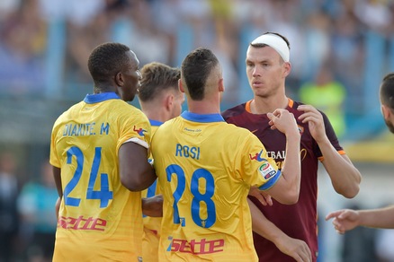 Dzeko, scontro aereo e fasciatura alla testa con il Frosinone