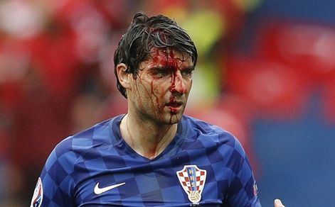 Corluka, che paura! Il suo volto è una maschera di sangue