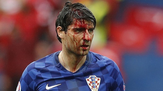Corluka, che paura! Il suo volto è una maschera di sangue