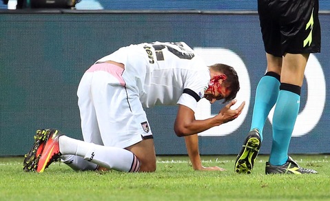 Inter-Palermo: Balogh infortunio choc, colpito da D'ambrosio