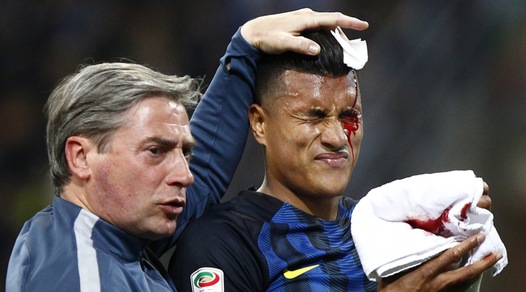 Murillo, che botta con Koulibaly! Poi continua a giocare bendato