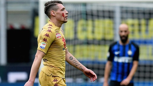 Torino, Belotti perde sangue dallo zigomo