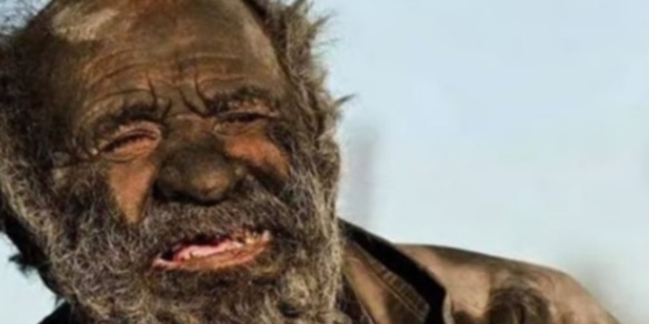 È morto l'uomo più sporco del mondo: non si lavava dal 1954!