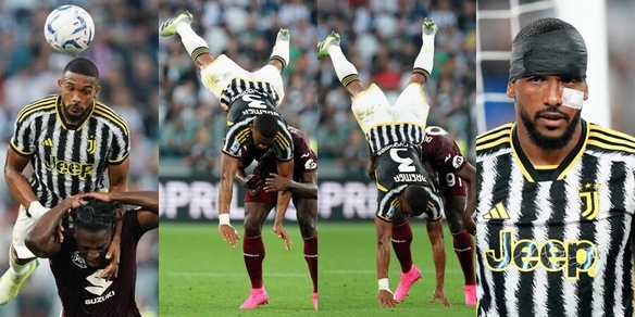 Bremer, la dura giornata dell'ex in Juve-Torino