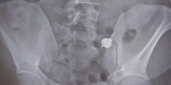 Imbroglia all’esame della patente: scoperto, ingoia l’auricolare