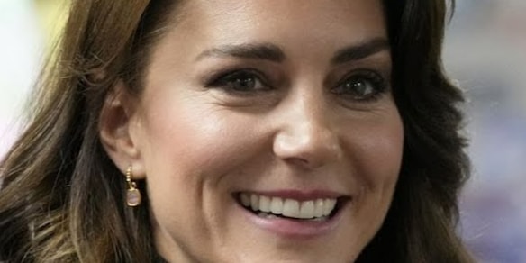 Kate Middleton non è più la stessa dopo il cancro: com'è cambiata e come sta oggi