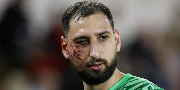 Donnarumma, Singo e il colpo in faccia: cosa ha deciso il Giudice Sportivo