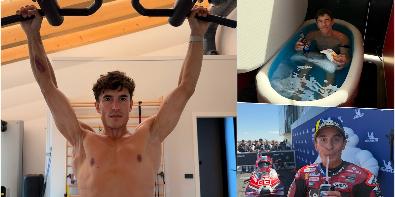 <p>Marc Marquez da brividi, il braccio è impressionante: com'è ridotto dopo sette interventi</p>