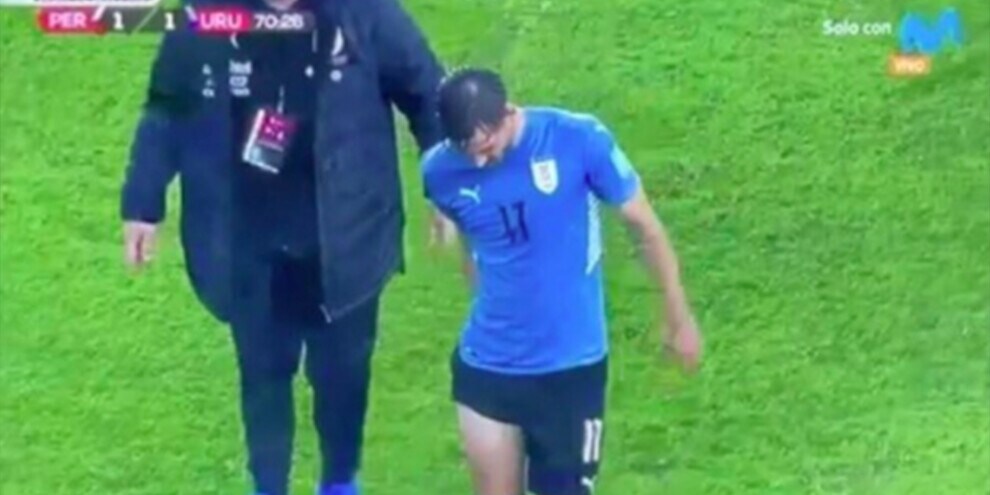 Roma, ansia per Vina: infortunio muscolare con l'Uruguay
