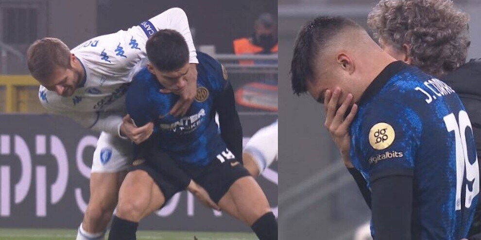 Inter-Empoli, Correa subito ko: lascia il campo in lacrime