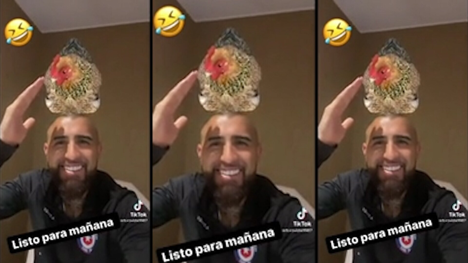 Vidal si prepara ad affrontare l'Uruguay...con una gallina