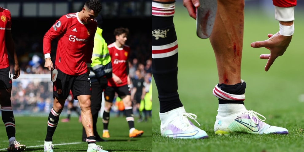 cr7 scarpe da calcio