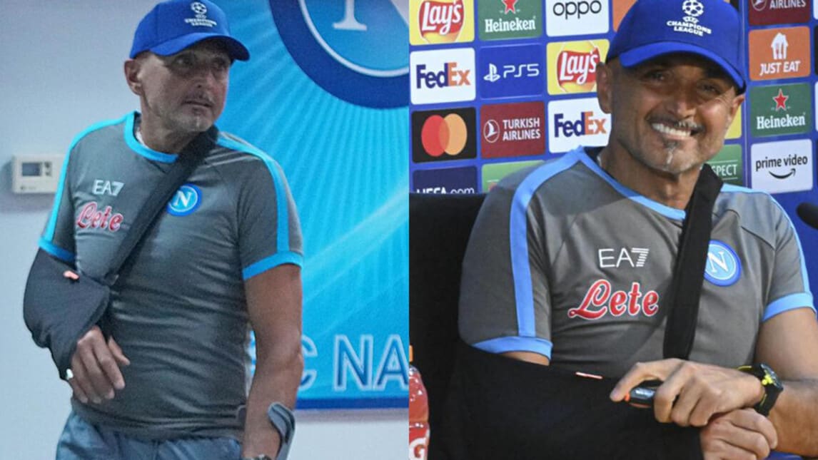 Napoli, Spalletti con tutore e stampella in conferenza stampa