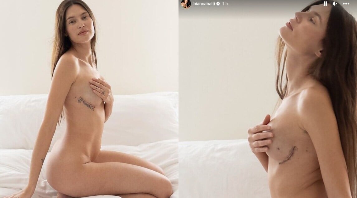 Bianca Balti nuda mostra le cicatrici: "Nuovo anno, nuova me"